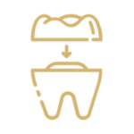 dental crowns treatments smile builders tijuana