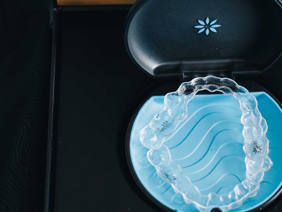 10 things you need to know about Invisalign