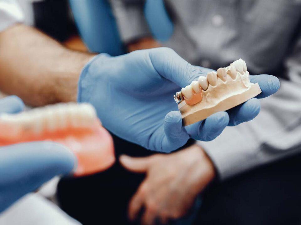 Choosing a High-Quality Dental Implant Brand Does Matter