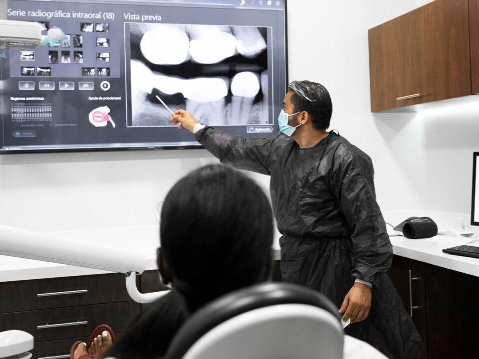 Frequently Asked Questions: About All-on-4® Dental Implants in Mexico Answered