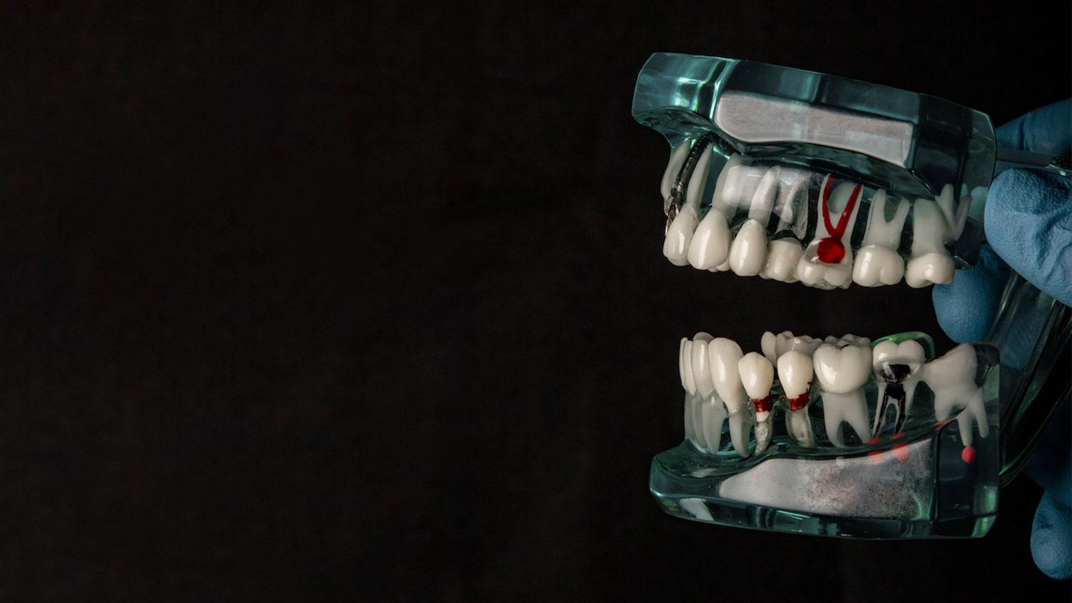 Beyond Straight Teeth: How Orthodontics Can Address TMJ Pain and Dysfunction